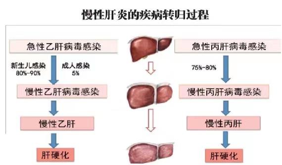 【健康科普】世界肝炎日——堅(jiān)持早預(yù)防,加強(qiáng)檢測發(fā)現(xiàn),規(guī)范抗病毒治療